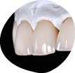 低価格/良質の歯